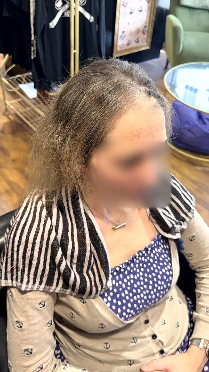 Before: fine, thin hair with the scalp showing along the parting
